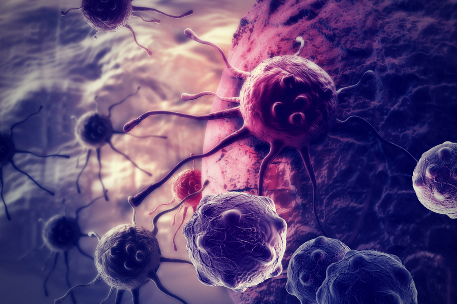 Imunoterapia: o maior avanço no tratamento do câncer nos últimos anos